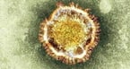 MERS-CoV - Should Indians be worried? (Expert Interview)