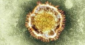 Time to take the MERS CoV threat seriously