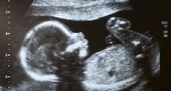 The first ultrasound shows that our baby isn't growing properly (Query)
