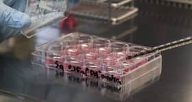 Stem cell treatment -- a boon for burn victims