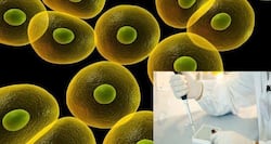 Stem cell therapy - what you ought to know