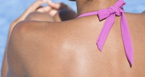 How do I get rid of strap marks? (Beauty Query)