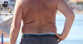How to get rid of stretch marks