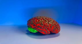 Stroke in Youth : युवाओं में स्ट्रोक के मामलों में वृद्धि, इलाज में देरी से जा सकती है जान