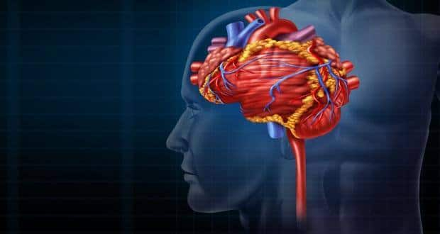 Monitor pulse after stroke to avoid second