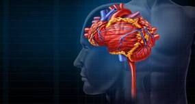 Monitor pulse after stroke to avoid second