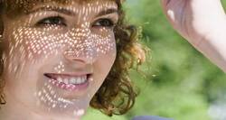 DIY tips to heal sunburn at home