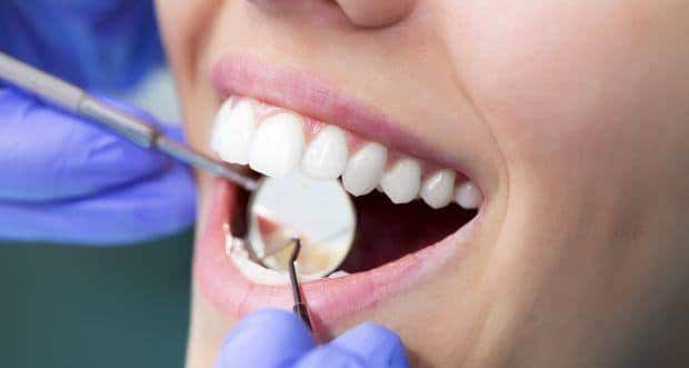 Teeth Sensitivity Causes And Treatment