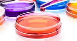 IGRA, the new tuberculosis diagnostic tool - pros and cons