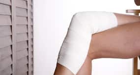 Varicose veins: Symptoms, diagnosis and treatment options