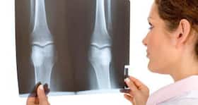 Coming soon - A bone substitute without toxins