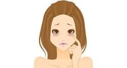 डार्क सर्कल्स के कारण