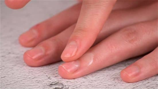 Causes of Skin Peeling on Fingernails