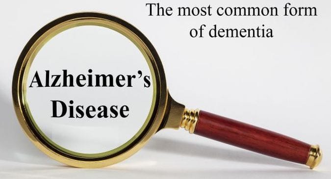 A protein in your brain can be your weapon against Alzheimer's disease