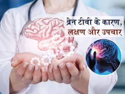 ब्रेन टीबी के कारण, लक्षण, इलाज और उपचार