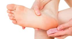 सर्दियों में फटी एड़ियों के लिए शहनाज़ हुसैन टिप्स।