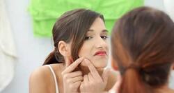 पिम्पल्स के दाग कम करने के लिए घरेलू नुस्खे।