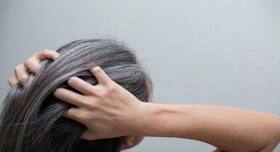 6 Useful Home Remedies To Get Rid Of White Hair