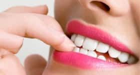 शादियों के सीजन के लिए ओरल केयर टिप्स।