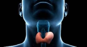 Prevent hypothyroidism with diet modifications