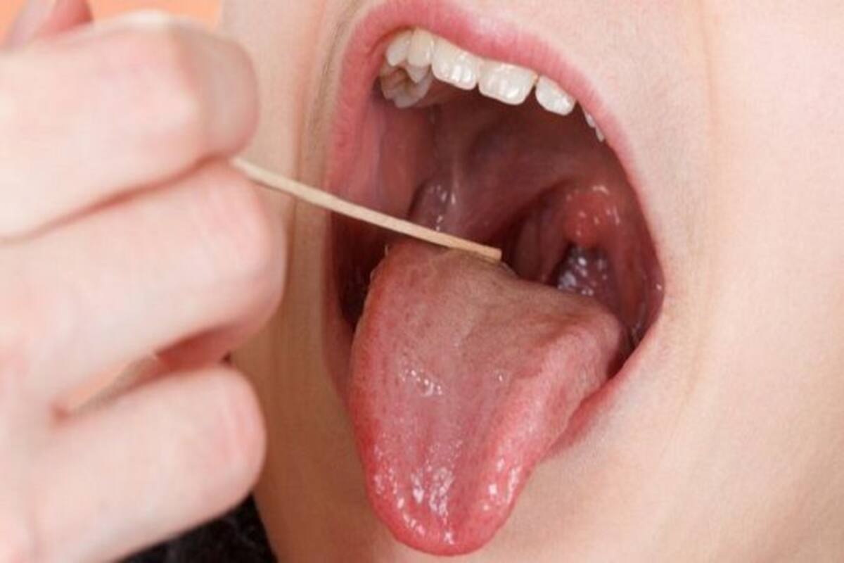 Sore Tongue Here Are 5 Effective Home Remedies To Relieve The Pain The best cure for boils is to treat them as soon as they start developing. sore tongue here are 5 effective home
