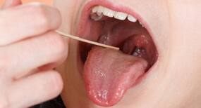 Sore Tongue: 5 Effective Home Remedies to Relieve the Pain