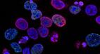 Colorectal Cancer: एस्पिरिन दवा से कोलोरेक्टल कैंसर का बचाव, कोलन कैंसर से बचने के घरेलू उपाय
