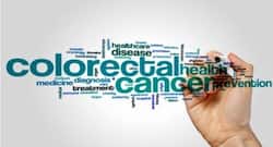 Aspirin may curb colorectal cancer recurrence, tumour growth