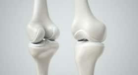 Want healthy bones? Eat well and lead an active life Want healthy bones? Eat well and lead an active life