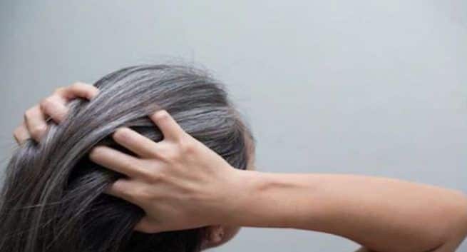 White Hair ब ल सफ द ह न स र कन क उप य