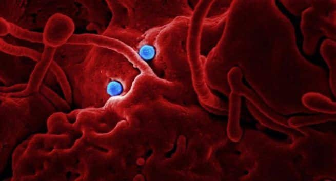 what is CoronaVirus know symptoms and risks Coronavirus Cure Treatment and prevention