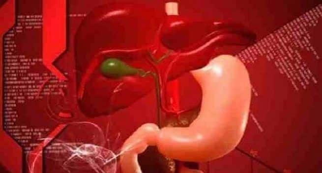 Fatty Liver Disease Consuming Green Tea Can decrease Its Severity
