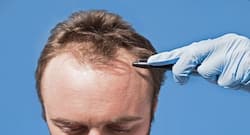 Stressful lifestyle ‘a major factor for hair loss in men’: Follow these tips to manage your stress