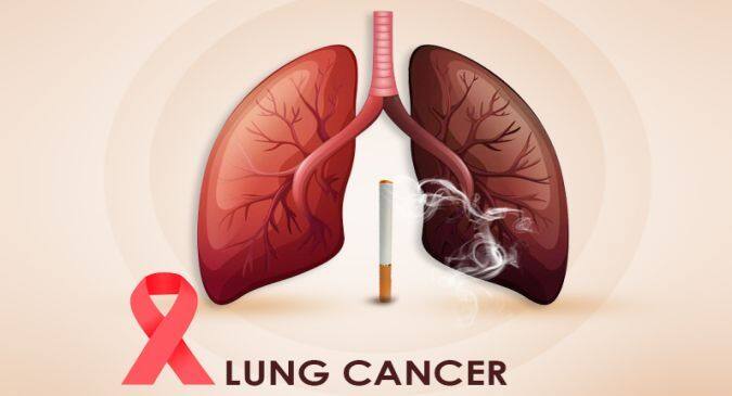 Lung cancer in Women: फेफड़ों का कैंसर महिलाओं में | TheHealthSite