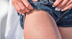 मेकअप से स्ट्रेच मार्क्‍स छिपाने के टिप्स