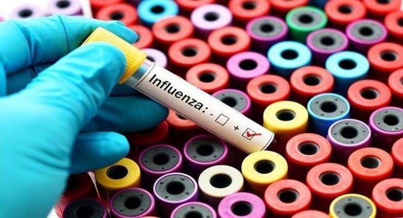 5 deadliest viruses on earth besides coronaviruses