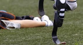 Bizarre: You may willingly amputate a healthy limb if you have body integrity identity disorder