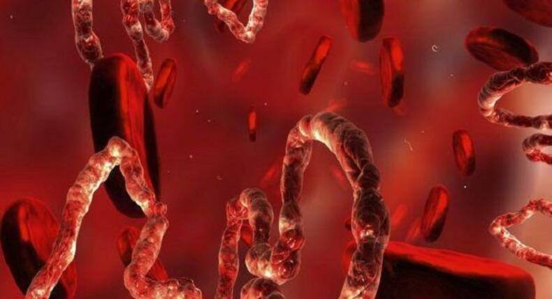 5 deadliest viruses on earth besides coronaviruses
