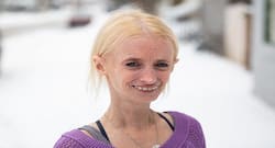 Bizarre: Progeria can make a child of 8 look like an 80-year-old