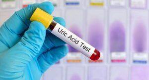 uric-acid problem