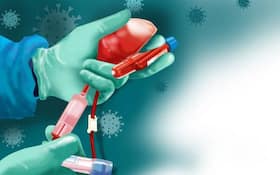 Plasma Therapy: क्‍या होती है प्लाज्मा थेरेपी? कैसे करती है काम प्लाज्मा थेरेपी?