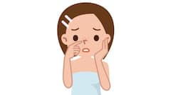 ब्लैकहेड्स के लिए घरेलू उपाय, ब्लैकहेड्स के लिए क्या करें ?