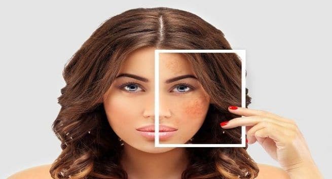 Skin Care mistakes