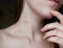 World Blood Cancer Day2021: ब्लड कैंसर के प्रमुख लक्षण ।