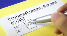 Peritoneal cancer is not only rare but can easily be confused with ovarian cancer