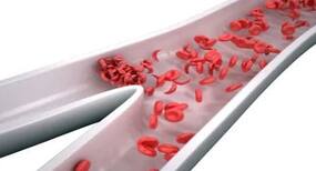 world sickle cell day 2020 : सिकल सेल क्या है? पहचाने इसके लक्षण