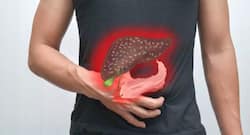 Hepatitis E: Should you be worried about this viral infection?
