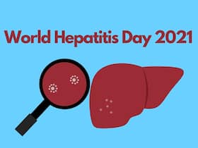 World Hepatitis Day 2021: Post-Covid-19 Care In Patients With Hepatitis World Hepatitis Day 2021: Post-Covid-19 Care In Patients With Hepatitis