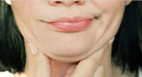Chew gums and pout often to get rid of double chin