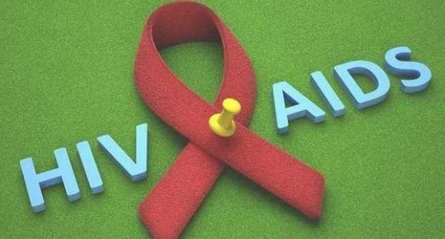 hivaids